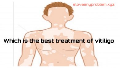 Which Is the Best Vitiligo Treatment?